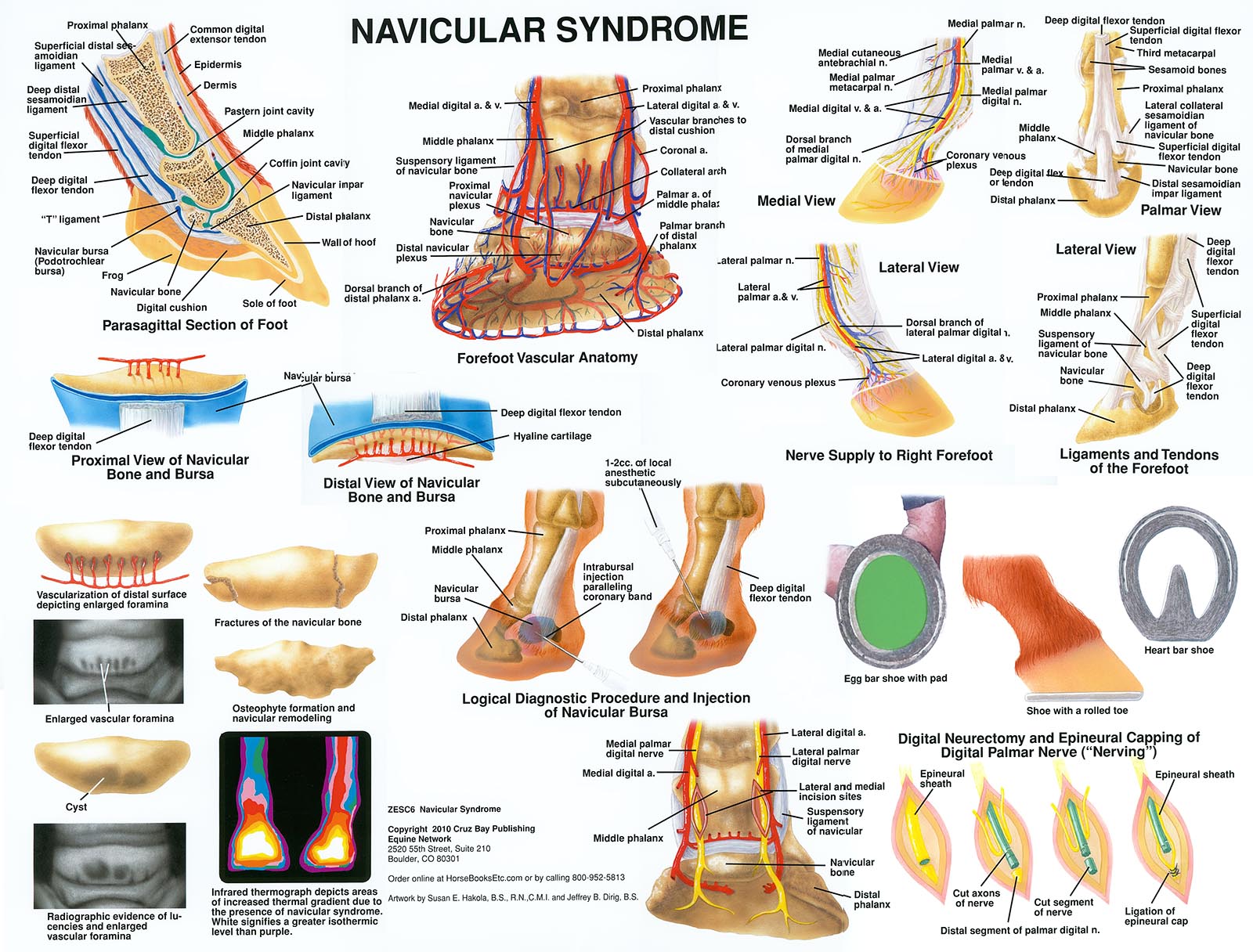 Navicular Syndrome
